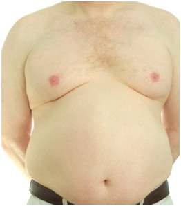 Man with big belly